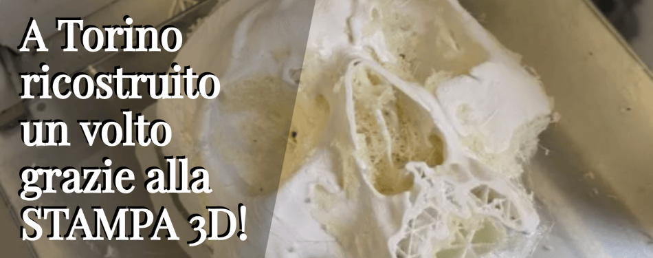 A TORINO &Egrave; STATO RICOSTRUITO UN VOLTO GRAZIE ALLA STAMPA 3D!